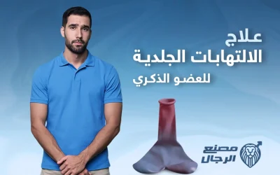 ما وسائل علاج الالتهابات الجلدية للعضو الذكري؟